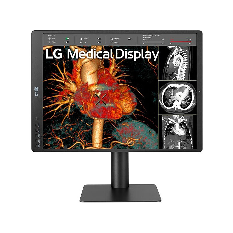 LG 21in Medical Monitor 21HQ513D-S
