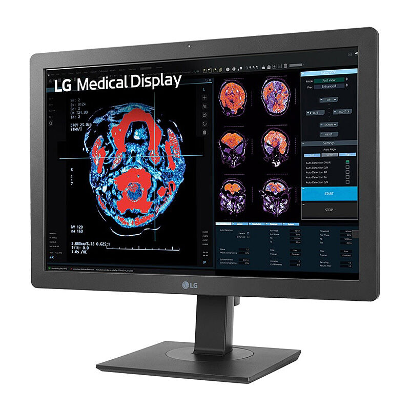 LG 24in Clinical Review Monitor with Calibration Sensor