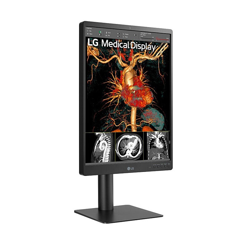 LG 21in Medical Monitor 21HQ513D-S