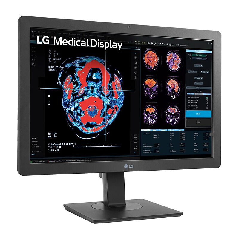 LG 24in Clinical Review Monitor with Calibration Sensor